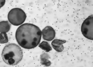 Algae – Based Microrobots Fight Cancer