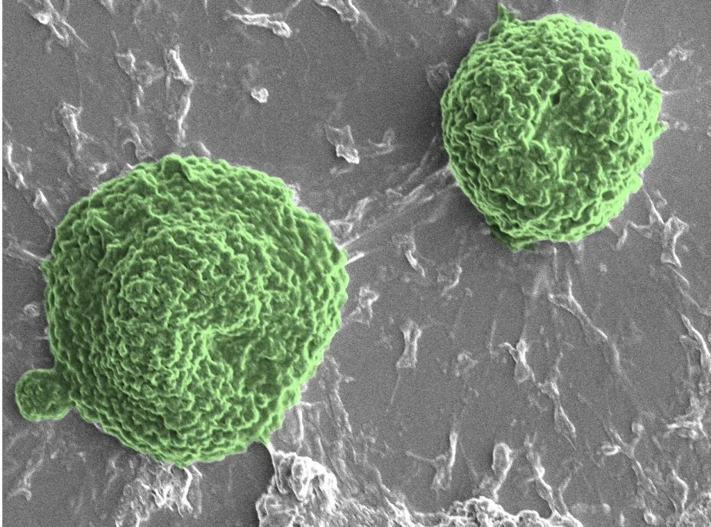 Scanning electron microscopy image of Volvox algae (pseudocolored green)