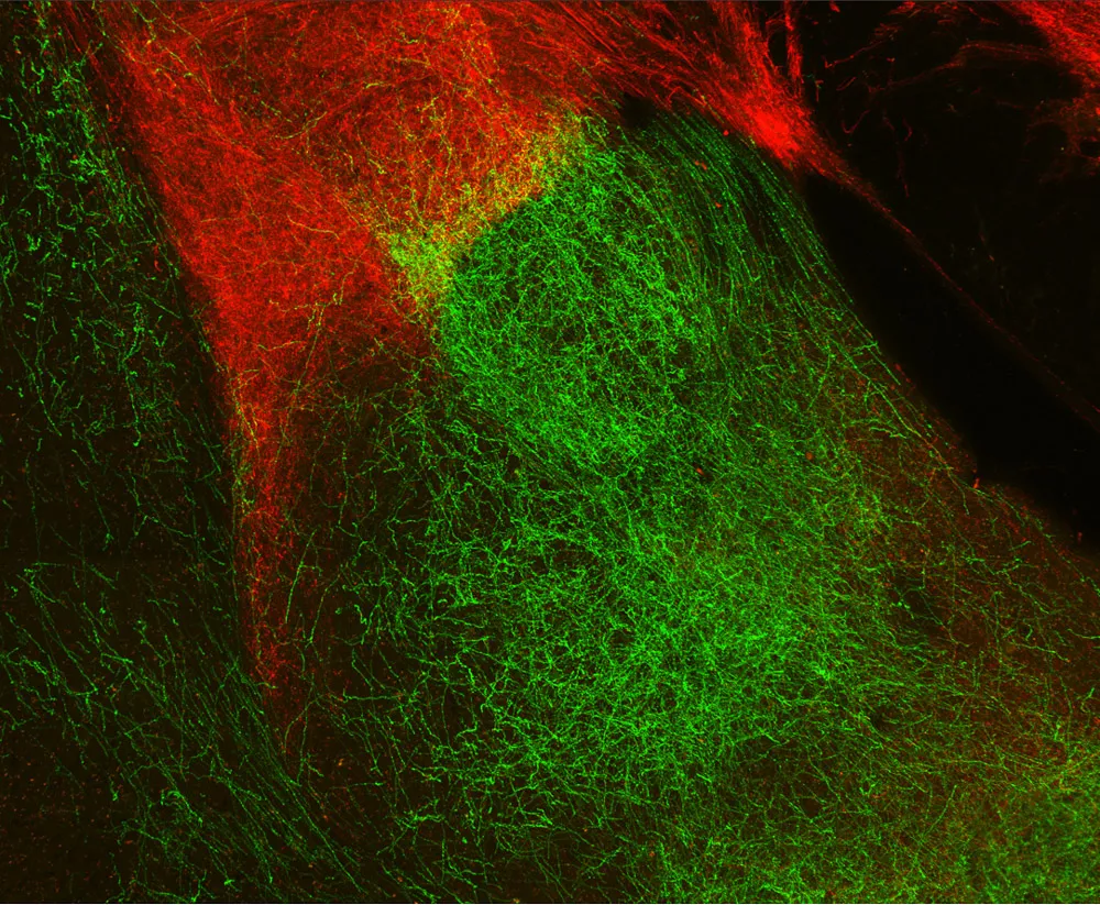 Neurons from several regions of the brain’s thalamus extend axons into the amygdala, but researchers found that only the paraventricular nucleus region (green) dictates valence.