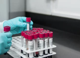 New blood test to diagnose Alzheimer’s disease via brain-derived protein