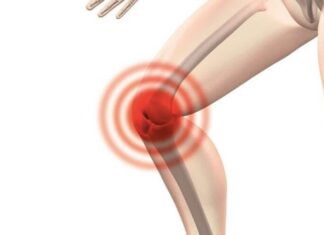 Do you have snapping knees? This is what it means and how you might fix it